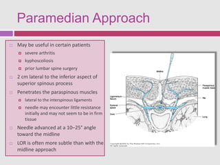 Paraspinous Injection 3722183.ppt