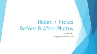 Rodan + Fields
Before & After Photos
Gale Klotsko
Independent Consultant
 