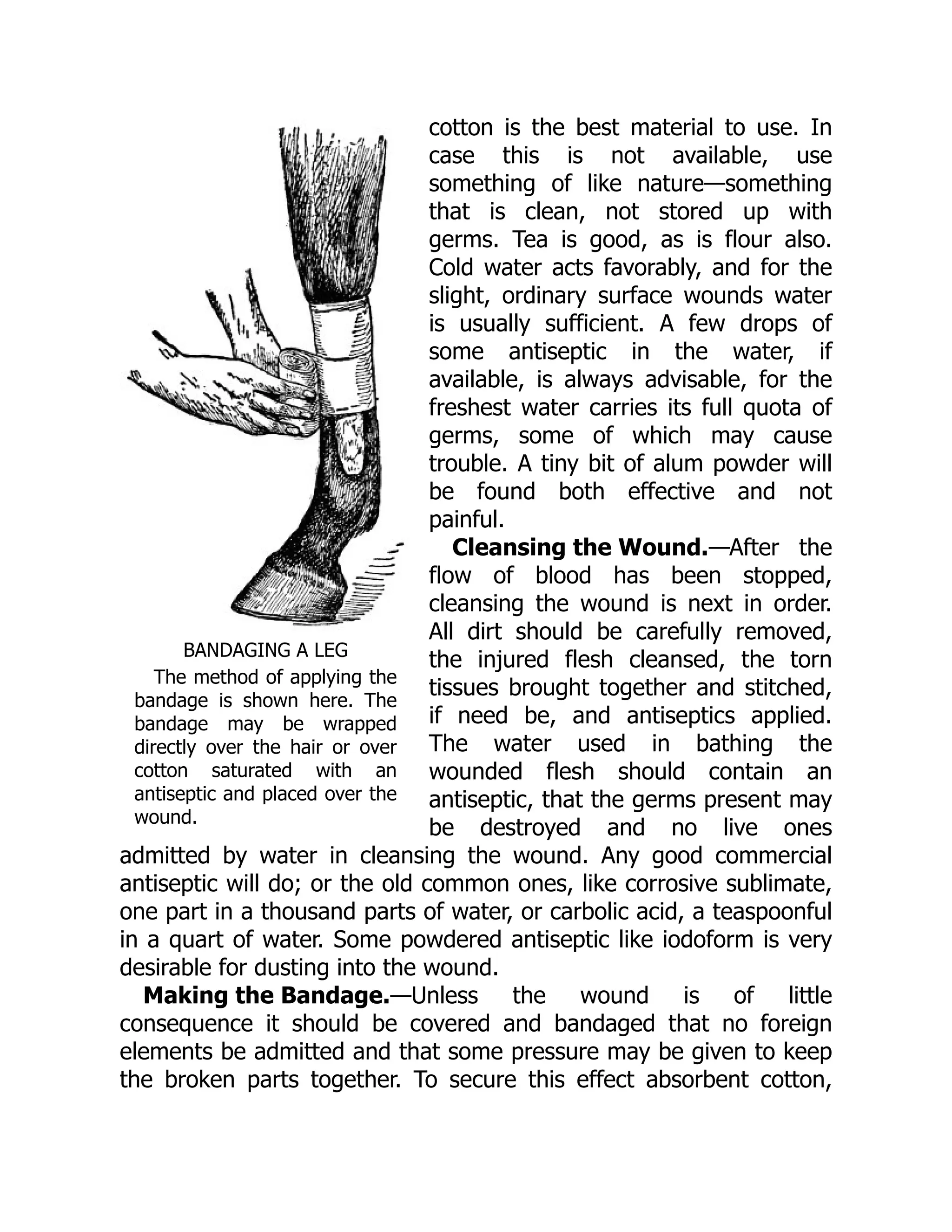BANDAGING A LEG
The method of applying the
bandage is shown here. The
bandage may be wrapped
directly over the hair or over
cotton saturated with an
antiseptic and placed over the
wound.
Cleansing the Wound.
Making the Bandage.
cotton is the best material to use. In
case this is not available, use
something of like nature—something
that is clean, not stored up with
germs. Tea is good, as is flour also.
Cold water acts favorably, and for the
slight, ordinary surface wounds water
is usually sufficient. A few drops of
some antiseptic in the water, if
available, is always advisable, for the
freshest water carries its full quota of
germs, some of which may cause
trouble. A tiny bit of alum powder will
be found both effective and not
painful.
—After the
flow of blood has been stopped,
cleansing the wound is next in order.
All dirt should be carefully removed,
the injured flesh cleansed, the torn
tissues brought together and stitched,
if need be, and antiseptics applied.
The water used in bathing the
wounded flesh should contain an
antiseptic, that the germs present may
be destroyed and no live ones
admitted by water in cleansing the wound. Any good commercial
antiseptic will do; or the old common ones, like corrosive sublimate,
one part in a thousand parts of water, or carbolic acid, a teaspoonful
in a quart of water. Some powdered antiseptic like iodoform is very
desirable for dusting into the wound.
—Unless the wound is of little
consequence it should be covered and bandaged that no foreign
elements be admitted and that some pressure may be given to keep
the broken parts together. To secure this effect absorbent cotton,
 