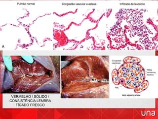 VERMELHO / SÓLIDO /
CONSISTÊNCIA LEMBRA
FÍGADO FRESCO
 