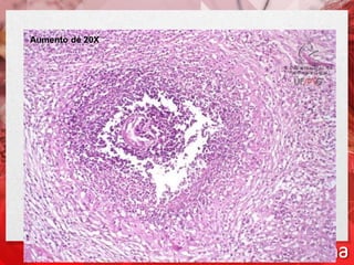 Aumento de 20X
 