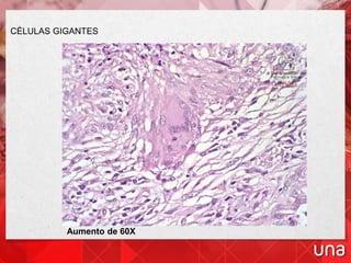 Aumento de 60X
CÉLULAS GIGANTES
 