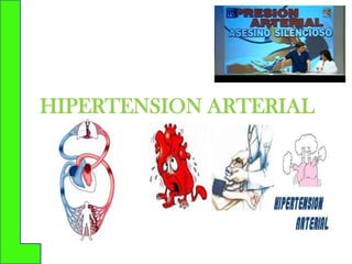HIPERTENSION ARTERIAL

 