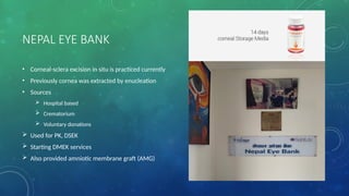 NEPAL EYE BANK
• Corneal-sclera excision in situ is practiced currently
• Previously cornea was extracted by enucleation
• Sources
 Hospital based
 Crematorium
 Voluntary donations
 Used for PK, DSEK
 Starting DMEK services
 Also provided amniotic membrane graft (AMG)
 
