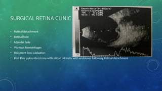 SURGICAL RETINA CLINIC
• Retinal detachment
• Retinal hole
• Macular hole
• Vitreous hemorrhages
• Recurrent lens sublxation
• Post Pars palna vitrectomy with silicon oil insitu with endolaser following Retinal detachment
 