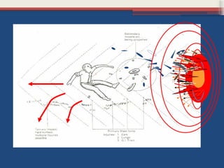 Small Explosive Injuries Comprehensive Overview of Injuries Caused by Explosive Forces and Blast ...