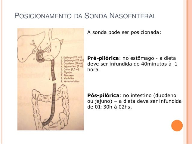 SONDA NASOGASTRICA E NASOENTERAL PDF DOWNLOAD SONDA NASOGASTRICA E NASOENTERAL PDF DOWNLOAD