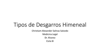 Tipos de Desgarros Himeneal
Christiam Alexander Salinas Salcedo
Medicina Legal
Dr. Alvarez
Ciclo XI
 