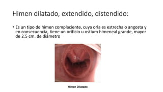 tipos-de-desgarros-himeneal-pptx