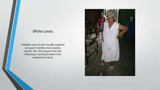 White canes
Foldable canes for the visually impaired
can grant mobility once properly
trained. Mrs. Dominguez tries hers
following a cooking accident that
rendered her blind.
 