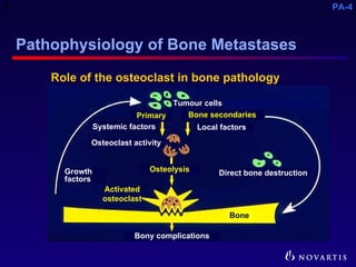 Pathophysiology of Metastatic Bone Disease and the Role of ...