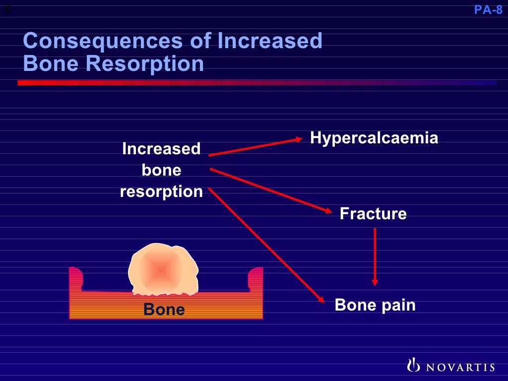 Pathophysiology of Metastatic Bone Disease and the Role of Bisphosp…