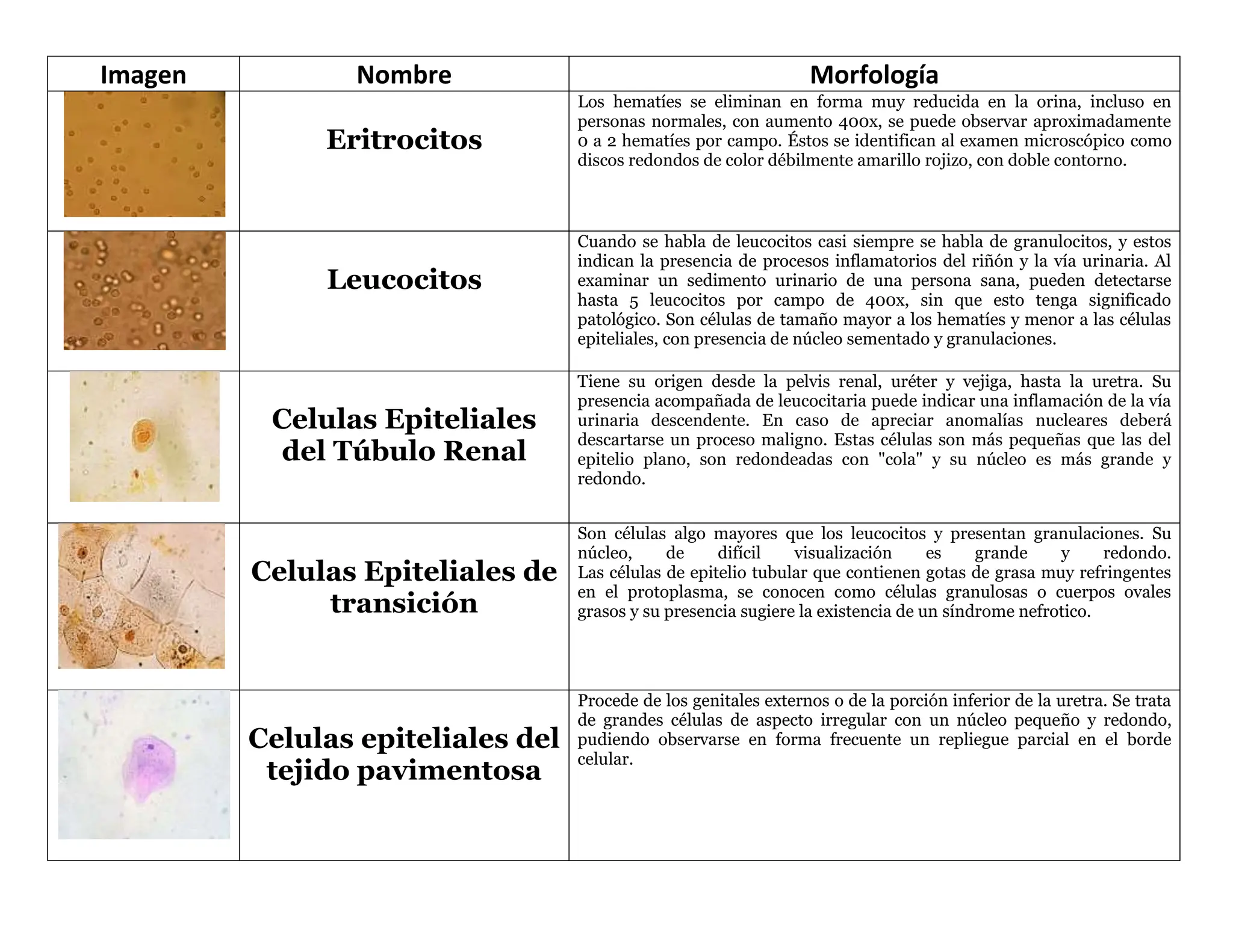 384634555 Sedimento Urinario docx docx 384634555-sedimento-urinario-docx-docx