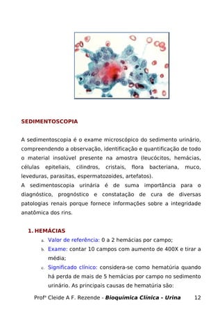 SEDIMENTOSCOPIA


A sedimentoscopia é o exame microscópico do sedimento urinário,
compreendendo a observação, identificação e quantificação de todo
o material insolúvel presente na amostra (leucócitos, hemácias,
células    epiteliais,   cilindros,   cristais,   flora   bacteriana,   muco,
leveduras, parasitas, espermatozoides, artefatos).
A sedimentoscopia urinária é de suma importância para o
diagnóstico, prognóstico e constatação de cura de diversas
patologias renais porque fornece informações sobre a integridade
anatômica dos rins.


  1. HEMÁCIAS
          a. Valor de referência: 0 a 2 hemácias por campo;

          b. Exame: contar 10 campos com aumento de 400X e tirar a

            média;
          c. Significado clínico: considera-se como hematúria quando

            há perda de mais de 5 hemácias por campo no sedimento
            urinário. As principais causas de hematúria são:

    Profa Cleide A F. Rezende - Bioquímica Clínica - Urina                12
 