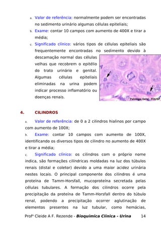 a. Valor de referência: normalmente podem ser encontradas

            no sedimento urinário algumas células epiteliais;
          b. Exame: contar 10 campos com aumento de 400X e tirar a

            média;
          c. Significado clínico: vários tipos de células epiteliais são

            frequentemente encontradas no sedimento devido à
            descamação normal das células
            velhas que recobrem o epitélio
            do    trato    urinário    e    genital.
            Algumas        células         epiteliais
            eliminadas      na   urina       podem
            indicar processo inflamatório ou
            doenças renais.



4.          CILINDROS

     a.     Valor de referência: de 0 a 2 cilindros hialinos por campo
     com aumento de 100X;
     b.     Exame: contar 10 campos com aumento de 100X,
     identificando os diversos tipos de cilindro no aumento de 400X
     e tirar a média;
     c.     Significado clínico: os cilindros com o próprio nome
     indica, são formações cilíndricas moldadas na luz dos túbulos
     renais (distal e coletor) devido a uma maior acidez urinária
     nestes locais. O principal componente dos cilindros é uma
     proteína de Tamm-Horsfall, mucoproteína secretada pelas
     células tubulares. A formação dos cilindros ocorre pela
     precipitação da proteína de Tamm-Horsfall dentro do túbulo
     renal,      podendo     a   precipitação       ocorrer    aglutinação   de
     elementos       presentes        na    luz   tubular,    como   hemácias,

     Profa Cleide A F. Rezende - Bioquímica Clínica - Urina                  14
 