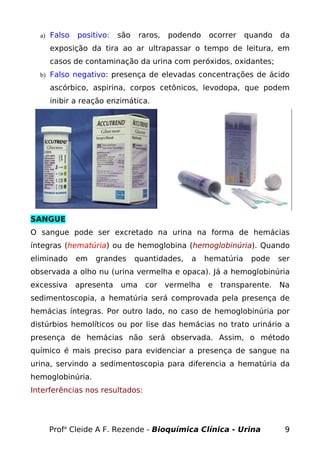 a) Falso   positivo:   são   raros,   podendo     ocorrer    quando   da
     exposição da tira ao ar ultrapassar o tempo de leitura, em
     casos de contaminação da urina com peróxidos, oxidantes;
  b) Falso negativo: presença de elevadas concentrações de ácido

     ascórbico, aspirina, corpos cetônicos, levodopa, que podem
     inibir a reação enzimática.




SANGUE
O sangue pode ser excretado na urina na forma de hemácias
íntegras (hematúria) ou de hemoglobina (hemoglobinúria). Quando
eliminado    em   grandes      quantidades,   a    hematúria    pode    ser
observada a olho nu (urina vermelha e opaca). Já a hemoglobinúria
excessiva    apresenta   uma     cor    vermelha   e   transparente.    Na
sedimentoscopia, a hematúria será comprovada pela presença de
hemácias íntegras. Por outro lado, no caso de hemoglobinúria por
distúrbios hemolíticos ou por lise das hemácias no trato urinário a
presença de hemácias não será observada. Assim, o método
químico é mais preciso para evidenciar a presença de sangue na
urina, servindo a sedimentoscopia para diferencia a hematúria da
hemoglobinúria.
Interferências nos resultados:




    Profa Cleide A F. Rezende - Bioquímica Clínica - Urina               9
 