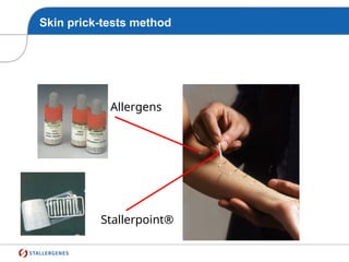 Stallerpoint®
Allergens
Skin prick-tests method
 