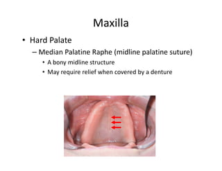 Maxilla
• Hard Palate
  – Median Palatine Raphe (midline palatine suture)
     • A bony midline structure
     • May require relief when covered by a denture
 