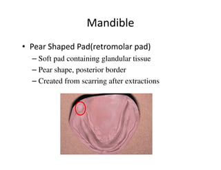 Mandible
• Pear Shaped Pad(retromolar pad)
  – Soft pad containing glandular tissue
  – Pear shape, posterior border
  – Created from scarring after extractions
 