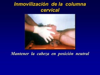 Inmovilización de la columna
cervical
Mantener la cabeza en posición neutral
 