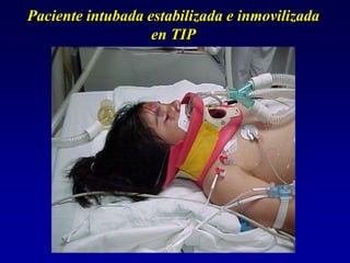 Paciente intubada estabilizada e inmovilizada
en TIP
 