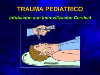 TRAUMA PEDIATRICO
Intubación con Inmovilización Cervical
 