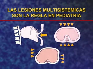 LAS LESIONES MULTISISTEMICAS
SON LA REGLA EN PEDIATRIA
 