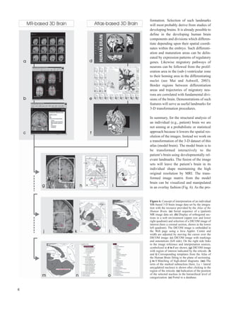 Atlas of the Human Brain 2nd Edition Jürgen K. Mai | PDF
