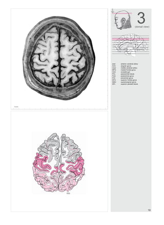 Atlas of the Human Brain 2nd Edition Jürgen K. Mai | PDF