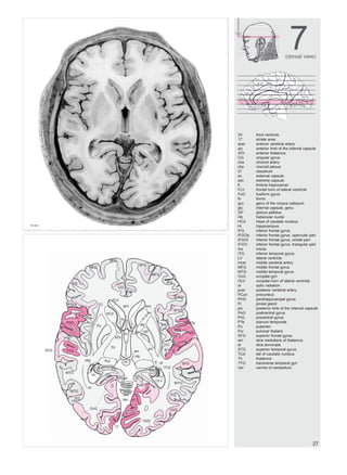Atlas of the Human Brain 2nd Edition Jürgen K. Mai | PDF
