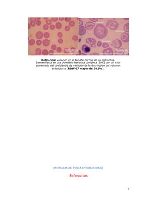 Bhc Normal 38990220 atlas-de-hematologia | PDF