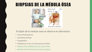 BIOPSIAS DE LA MÉDULA ÓSEA
El tejido de la medula osea se observa en laboratorio
• Inmunohistoquimica
• Citometria de flujo
• Citogenetica
• Hibridacion in situ con fluorescencia (FISH)
• BIOPSIA POR ASPIRACION DE AGUJA FINA
• BIOPSIA POR PUNCION DE AGUJA GRUESA
 