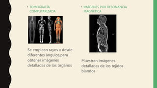 • TOMOGRAFÍA
COMPUTARIZADA
Se emplean rayos x desde
diferentes ángulos,para
obtener imágenes
detalladas de los órganos
• IMÁGENES POR RESONANCIA
MAGNÉTICA
Muestran imágenes
detalladas de los tejidos
blandos
 