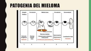 PATOGENIA DEL MIELOMA
 