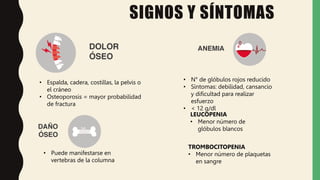 • Espalda, cadera, costillas, la pelvis o
el cráneo
• Osteoporosis = mayor probabilidad
de fractura
• N° de glóbulos rojos reducido
• Síntomas: debilidad, cansancio
y dificultad para realizar
esfuerzo
• < 12 g/dl
LEUCOPENIA
• Menor número de
glóbulos blancos
TROMBOCITOPENIA
• Menor número de plaquetas
en sangre
• Puede manifestarse en
vertebras de la columna
SIGNOS Y SÍNTOMAS
 