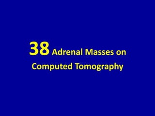 38Adrenal Masses on
Computed Tomography
 