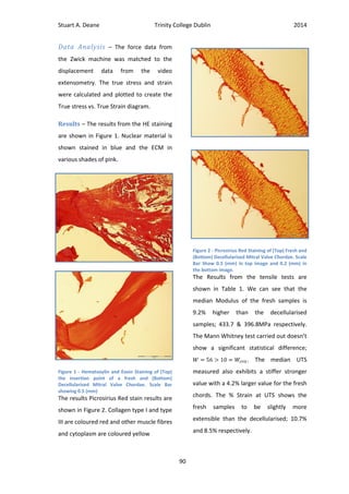 Stuart A. Deane Trinity College Dublin 2014
90
Data Analysis – The force data from
the Zwick machine was matched to the
displacement data from the video
extensometry. The true stress and strain
were calculated and plotted to create the
True stress vs. True Strain diagram.
Results – The results from the HE staining
are shown in Figure 1. Nuclear material is
shown stained in blue and the ECM in
various shades of pink.
Figure 1 - Hematoxylin and Eosin Staining of (Top)
the insertion point of a fresh and (Bottom)
Decellularised Mitral Valve Chordae. Scale Bar
showing 0.5 (mm)
The results Picrosirius Red stain results are
shown in Figure 2. Collagen type I and type
III are coloured red and other muscle fibres
and cytoplasm are coloured yellow
Figure 2 - Picrosirius Red Staining of (Top) Fresh and
(Bottom) Decellularised Mitral Valve Chordae. Scale
Bar Show 0.5 (mm) in top image and 0.2 (mm) in
the bottom image.
The Results from the tensile tests are
shown in Table 1. We can see that the
median Modulus of the fresh samples is
9.2% higher than the decellularised
samples; 433.7 & 396.8MPa respectively.
The Mann Whitney test carried out doesn’t
show a significant statistical difference;
. The median UTS
measured also exhibits a stiffer stronger
value with a 4.2% larger value for the fresh
chords. The % Strain at UTS shows the
fresh samples to be slightly more
extensible than the decellularised; 10.7%
and 8.5% respectively.
 