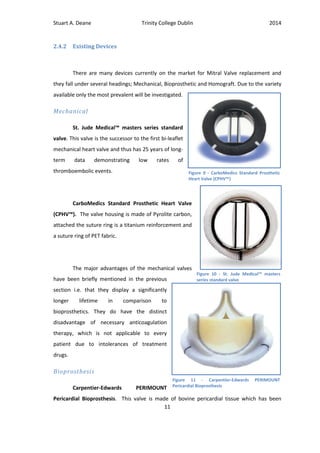 Stuart A. Deane Trinity College Dublin 2014
11
2.4.2 Existing Devices
There are many devices currently on the market for Mitral Valve replacement and
they fall under several headings; Mechanical, Bioprosthetic and Homograft. Due to the variety
available only the most prevalent will be investigated.
Mechanical
St. Jude Medical™ masters series standard
valve. This valve is the successor to the first bi-leaflet
mechanical heart valve and thus has 25 years of long-
term data demonstrating low rates of
thromboembolic events.
CarboMedics Standard Prosthetic Heart Valve
(CPHV™). The valve housing is made of Pyrolite carbon,
attached the suture ring is a titanium reinforcement and
a suture ring of PET fabric.
The major advantages of the mechanical valves
have been briefly mentioned in the previous
section i.e. that they display a significantly
longer lifetime in comparison to
bioprosthetics. They do have the distinct
disadvantage of necessary anticoagulation
therapy, which is not applicable to every
patient due to intolerances of treatment
drugs.
Bioprosthesis
Carpentier-Edwards PERIMOUNT
Pericardial Bioprosthesis. This valve is made of bovine pericardial tissue which has been
Figure 10 - St. Jude Medical™ masters
series standard valve
Figure 9 - CarboMedics Standard Prosthetic
Heart Valve (CPHV™)
Figure 11 - Carpentier-Edwards PERIMOUNT
Pericardial Bioprosthesis
 