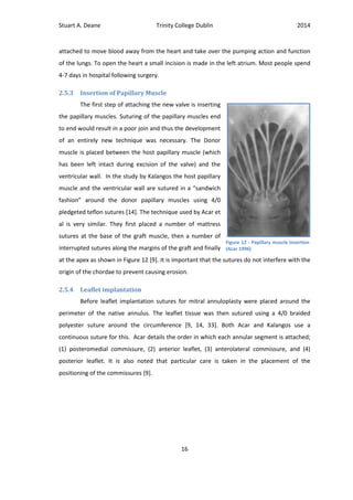 Stuart A. Deane Trinity College Dublin 2014
16
attached to move blood away from the heart and take over the pumping action and function
of the lungs. To open the heart a small incision is made in the left atrium. Most people spend
4-7 days in hospital following surgery.
2.5.3 Insertion of Papillary Muscle
The first step of attaching the new valve is inserting
the papillary muscles. Suturing of the papillary muscles end
to end would result in a poor join and thus the development
of an entirely new technique was necessary. The Donor
muscle is placed between the host papillary muscle (which
has been left intact during excision of the valve) and the
ventricular wall. In the study by Kalangos the host papillary
muscle and the ventricular wall are sutured in a “sandwich
fashion” around the donor papillary muscles using 4/0
pledgeted teflon sutures [14]. The technique used by Acar et
al is very similar. They first placed a number of mattress
sutures at the base of the graft muscle, then a number of
interrupted sutures along the margins of the graft and finally
at the apex as shown in Figure 12 [9]. It is important that the sutures do not interfere with the
origin of the chordae to prevent causing erosion.
2.5.4 Leaflet implantation
Before leaflet implantation sutures for mitral annuloplasty were placed around the
perimeter of the native annulus. The leaflet tissue was then sutured using a 4/0 braided
polyester suture around the circumference [9, 14, 33]. Both Acar and Kalangos use a
continuous suture for this. Acar details the order in which each annular segment is attached;
(1) posteromedial commissure, (2) anterior leaflet, (3) anterolateral commissure, and (4)
posterior leaflet. It is also noted that particular care is taken in the placement of the
positioning of the commissures [9].
Figure 12 - Papillary muscle Insertion
(Acar 1996)
 