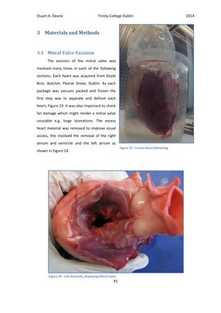Stuart A. Deane Trinity College Dublin 2014
41
3 Materials and Methods
3.1 Mitral Valve Excision
The excision of the mitral valve was
involved many times in each of the following
sections. Each heart was acquired from Doyle
Bros. Butcher, Pearse Street, Dublin. As each
package was vacuum packed and frozen the
first step was to separate and defrost each
heart, Figure 23. It was also important to check
for damage which might render a mitral valve
unusable e.g. large lacerations. The excess
heart material was removed to improve visual
access, this involved the removal of the right
atrium and ventricle and the left atrium as
shown in Figure 24.
Figure 23 - Frozen Heart Defrosting
Figure 24 - Left Ventricle, displaying Mitral Valve
 