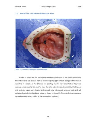 Stuart A. Deane Trinity College Dublin 2014
44
3.3 Additional Construct Dimension Test
In order to assess that the annuloplasty had been constructed to the correct dimensions
the mitral valve was excised from a heart weighing approximately 300(g) in the manner
described in section 3.1. The Chordae and papillary muscles were dissected as they were
deemed unnecessary for this test. To place the valve within the construct initially the trigones
and posterior aspect were located and secured using interrupted surgeons knots and 4/0
polyester braided non absorbable suture as shown in Figure 27. The rest of the annulus was
secured using the suture guides on the annuloplasty construct.
Figure 27 - Location of Trigones and Posterior Segment
 