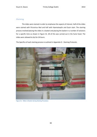 Stuart A. Deane Trinity College Dublin 2014
48
Staining
The slides were stained in order to emphasise the aspects of interest. Half of the slides
were stained with Picrosirius Red and half with Haematoxylin and Eosin stain. The staining
process involved placing the slides in a basket and placing the basket in a number of solutions
for a specific time as shown in Figure 31. All of this was carried out in the fume hood. The
slides were allowed to dry for 24 hours.
The Specifics of each staining process is outlined in Appendix D – Staining Protocols.
Figure 31 - Slides in Basket during Staining Procedure
 