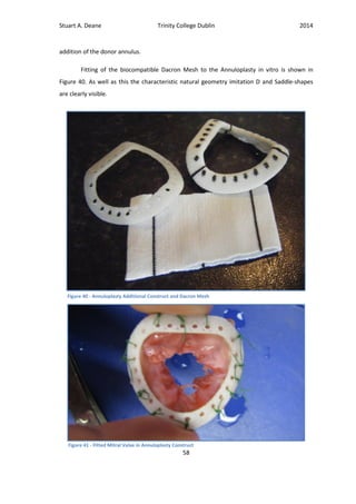 Stuart A. Deane Trinity College Dublin 2014
58
addition of the donor annulus.
Fitting of the biocompatible Dacron Mesh to the Annuloplasty in vitro is shown in
Figure 40. As well as this the characteristic natural geometry imitation D and Saddle-shapes
are clearly visible.
Figure 40 - Annuloplasty Additional Construct and Dacron Mesh
Figure 41 - Fitted Mitral Valve in Annuloplasty Construct
 