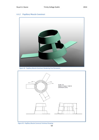 Stuart A. Deane Trinity College Dublin 2014
59
4.1.2 Papillary Muscle Construct
Figure 42 - Papillary Muscle Construct, Rendering Creo Parametric
Figure 43 - Papillary Muscle Construct Technical Drawing
 