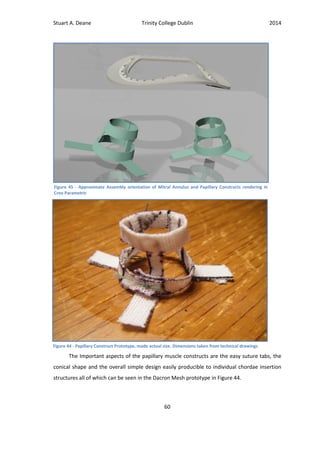 Stuart A. Deane Trinity College Dublin 2014
60
The Important aspects of the papillary muscle constructs are the easy suture tabs, the
conical shape and the overall simple design easily producible to individual chordae insertion
structures all of which can be seen in the Dacron Mesh prototype in Figure 44.
Figure 45 - Approximate Assembly orientation of Mitral Annulus and Papillary Constructs rendering in
Creo Parametric
Figure 44 - Papillary Construct Prototype, made actual size. Dimensions taken from technical drawings
 