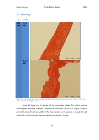 Stuart A. Deane Trinity College Dublin 2014
61
4.2 Histology
4.2.1 Leaflet
H&E
Stain
Fresh
10x
Decell
10x
Figure 46 shows the HE staining of the mitral valve leaflet. The nucleic material
(including RNA and DNA) is stained a deep blue-purple colour and the ECM varying shades of
pink. Cell material is clearly visible in the fresh sample and it appears as though the cell
material in the decellularised specimen has been completely removed.
Figure 46 - Hematoxylin and Eosin Staining of (Top) Fresh and (Bottom) decellularised Anterior Mitral Valve
Leaflet. Scale Bar showing 0.5 (mm)
 
