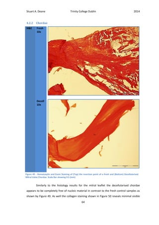 Stuart A. Deane Trinity College Dublin 2014
64
4.2.2 Chordae
H&E Fresh
10x
Decell
10x
Similarly to the histology results for the mitral leaflet the decellularised chordae
appears to be completely free of nucleic material in contrast to the fresh control samples as
shown by Figure 49. As well the collagen staining shown in Figure 50 reveals minimal visible
Figure 49 - Hematoxylin and Eosin Staining of (Top) the insertion point of a fresh and (Bottom) Decellularised
Mitral Valve Chordae. Scale Bar showing 0.5 (mm)
 