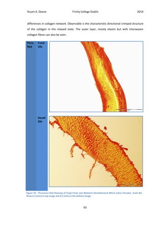 Stuart A. Deane Trinity College Dublin 2014
65
differences in collagen network. Observable is the characteristic directional crimped structure
of the collagen in the relaxed state. The outer layer, mostly elastin but with interwoven
collagen fibres can also be seen.
Picro
Red
Fresh
10x
Decell
20x
Figure 50 - Picrosirius Red Staining of (Top) Fresh and (Bottom) Decellularised Mitral Valve Chordae. Scale Bar
Show 0.5 (mm) in top image and 0.2 (mm) in the bottom image.
 