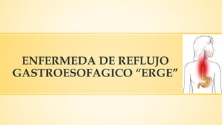 ENFERMEDA DE REFLUJO
GASTROESOFAGICO “ERGE”
 