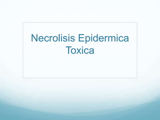 Necrolisis Epidermica
Toxica

 